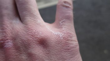 20140329_Rheinburgenweg_Etappe3_024